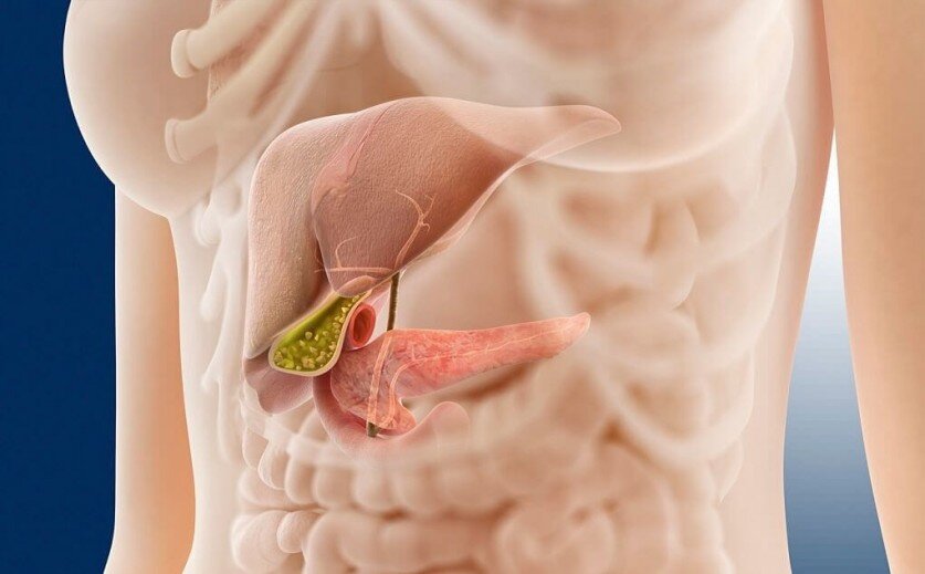 Хронический панкреатит – как успокоить поджелудочную железу?