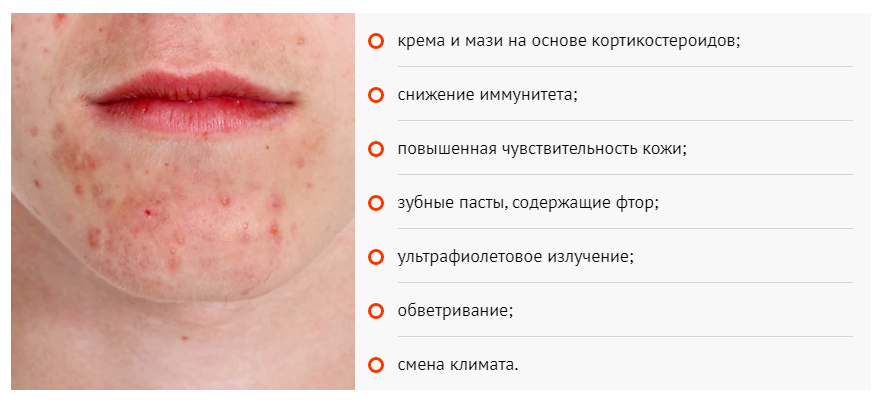 Причины периорального дерматита