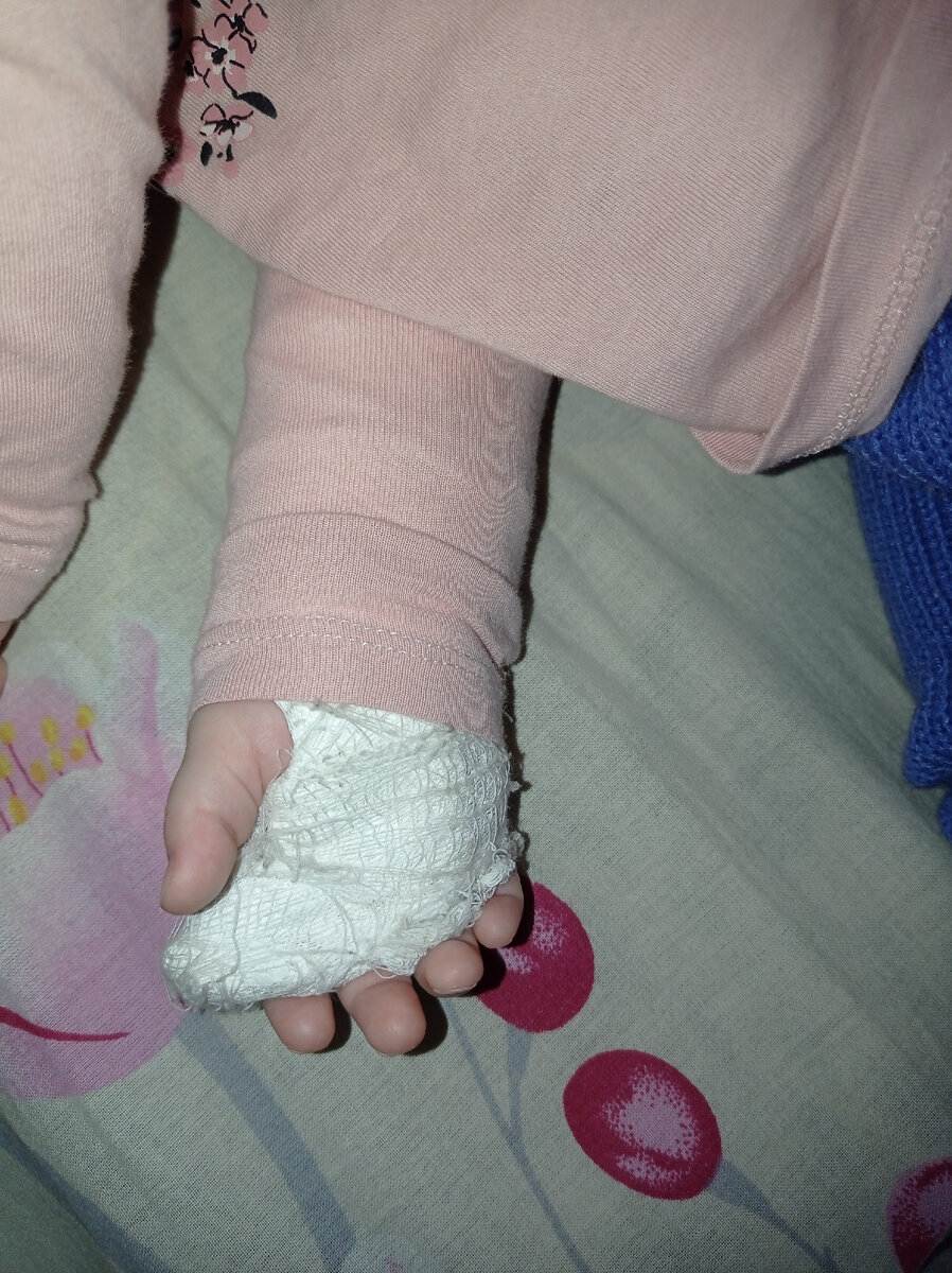 Вторая лангетка