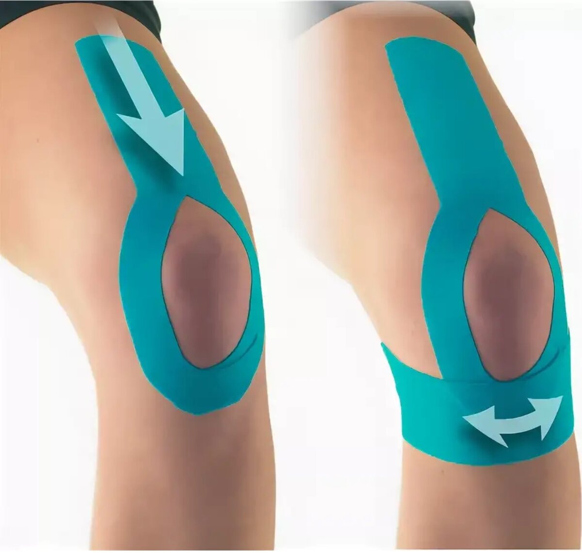 Фото взято в качестве иллюстрации у Яндекс-картинки 