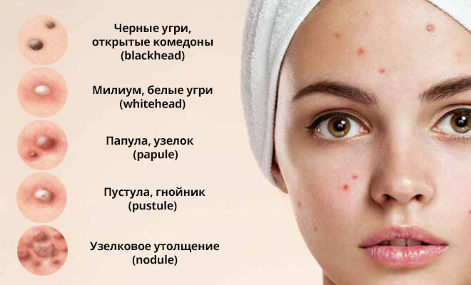 Виды высыпаний на лице: причины и как бороться | Christina Cosmetics