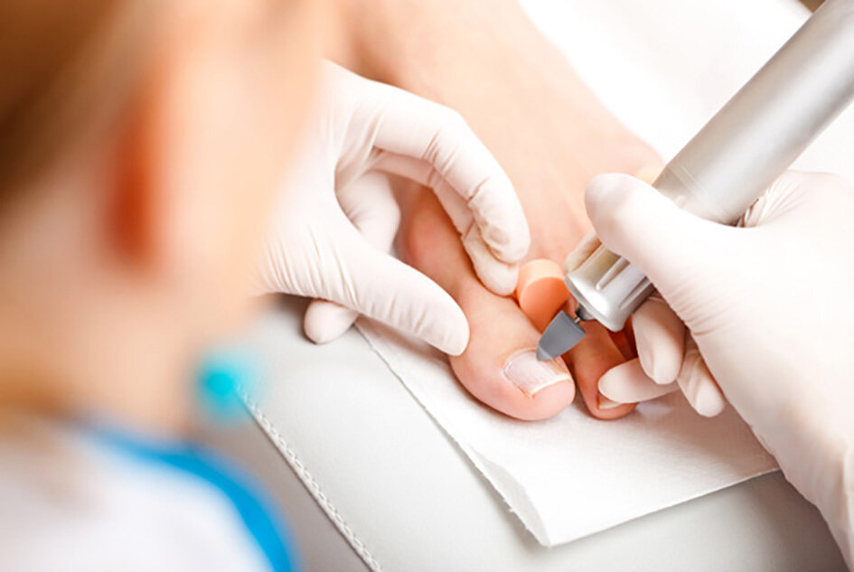 АППАРАТНЫЙ ПЕДИКЮР.