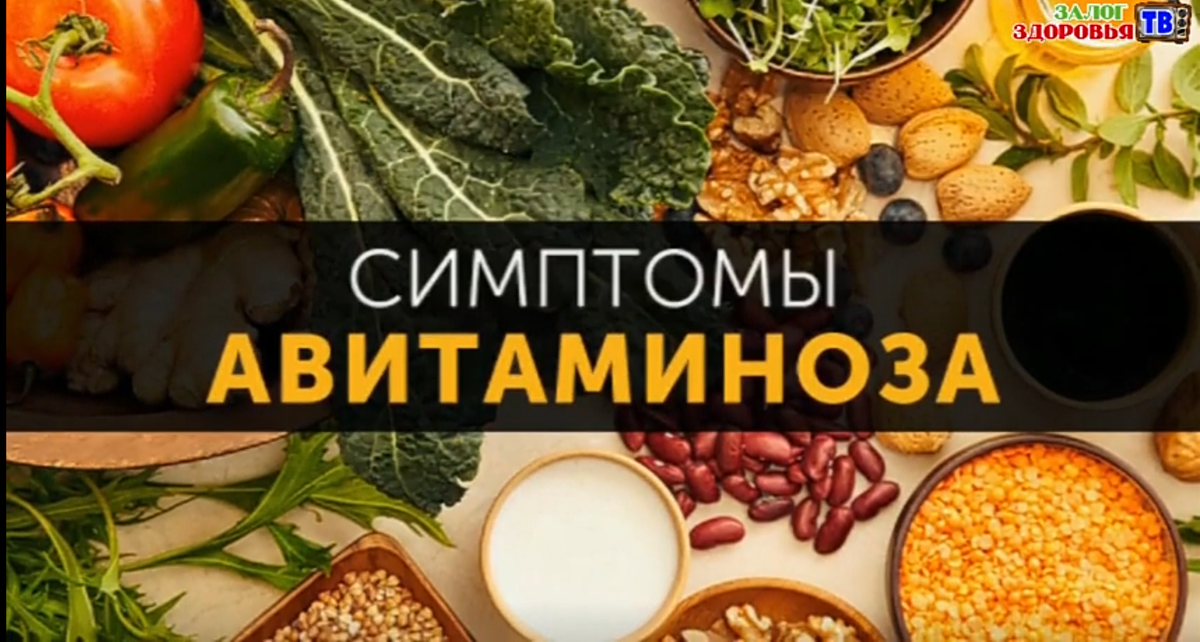 Здравствуйте дорогие друзья! Сегодня поговорим о дефиците витаминов в организме, особенно весной . 
 Наступила долгожданная весна, а вместе с ней пришли такие не приятные вещи, как ломкость ногтей и волос, тусклая, бледная кожа, кровоточивость дёсен, трещинки на губах, стойкое ощущение аппатии , раздражение и вялости. Кроме того, у многих, именно весной обостряются многие хронические заболевания, да и банальная простуда может длиться бесконечно долго. Всё это признаки авитаминоза, о котором мы наслышаны и которым мы напуганы.  Действительно ли всё так плохо ? На самом деле, большинство из нас, весной страдает не от авитаминоза, а от гиповитаминоза, тоесть, нехватки в организме тех, или иных витаминов, или минералов. Однако, народное название АВИТАМИНОЗ, прижилось у нас.  И мы им пользуемся часто, не подозревая что авитаминоз - это полное отсутствие витаминов в организме, это это грозное заболевание приводит к цинге, а в особо тяжелых случаях, к летальному исходу. К счастью, подобное явление - достаточно редко.
   И так, с терминами мы разобрались, теперь давайте определимся с причинами гиповитаминоза, который настигает нас в такое прекрасное время года, как весна. А главная причина, нехватки витаминов, недостаточное  получения их в пище. Понятно, что зимой количество фруктов и овощей, на нашем столе, резко снижается. Ситуация усложняется  тем фактом, что по утверждение ученых, за последние 50 лет, содержание витаминов в овощах и фруктах, значительно уменьшилась. На пример, яблоки и апельсины потеряли 66% витамина А. В курице количество количество того же витамина, снизилось на 70%, в зелени стало меньше кальция на 46%, а в капусте на 85. Этот список можно долго продолжать. Объяснить эту ситуацию можно просто, сегодня овощи и фрукты выращиваются, в большей части "фарсированными" методами, земледельцы стараются снять по два , а то и три урожая за сезон. За счёт этого почва сильно обедняется полезными веществами и соответственно эти вещества исчезают из плодов земледелия.
  Как известно, лучший способ лечения любой болезни - это её профилактика, так и с гиповитаминозом. Гораздо проще не допустить его развития, чем потом лечить последствия. Подавляющее большинство, при первых же признаках вялости и слабости, проблемах с кожей, ногтями и волосами, восклицают - всё понятно, авитаминоз и бросаются в аптеку, скупая там подряд все витамины и принимаються поедать их буквально горстями. А как же?  Вот и реклама утверждает, что нужно принимать поливитамины, аскорбинку и мультивитамины...  И на ярких коробочках написано, что они решают все проблемы. Такой, самостоятельно поставленный диагноз и самолечение, далеко не лучший выход из положения. Не думайте, что если витамины продаются без рецепта, значит можно их употреблять бесконтрольно. Ставить диагноз и прописывать лечение, может только врач ! Многие, кажущиеся безобидными пилюли и капсулы, способны серьезно навредить организму.
   Давайте всё-таки попробуем избежать недостатка витаминов, дополняя свой рацион натуральными природными источниками - это гораздо естественнее и безопаснее.

 Витамин А, например, относится к группе жирорастворимых витаминов и содержится в продуктах животного происхождения. Он оказывает  стимулирующее влияние на тканевое дыхание клеток, на обмен белков и углеводов, способствует ускорению обмена жиров и фосфолипидов, особенно велико влияние витамина А на функцию зрения ! Фоточувствительный пигмент, родопсин, находящийся в палочках сетчатки глаза, содержит витамин А и белок апсин. При недостаточности этого витамина в организме, зрительное восприятие в сумерках, нарушается, кроме того, нарушаются и многие обменные реакции, появляются сухость слизистых оболочек полости рта, желудка и кишечника, дыхательных путей, повышается слущивание поверхностных слоёв эпителия, всё это нарушает защитные свойства эпителиального барьера, создает благоприятные условия для проникновения болезнетворных микробов в организм. Витамин А, содержится в рыбе, яйцах, печени, твороге, молоке, помидорах, шпинате, зелёном салате, моркове, петрушке и почти во всех овощах.

   Витамин В1, защищает наши нервные клетки, помогает легче перенести стрессы, уменьшает чувство усталости.  Чтобы насытить организм витамином В1, нужно употреблять горох, фасоль, яйца, печень, молоко, дрожжи, ростки пшеницы и избегать чрезмерного потребления кофе, так как этот напиток способен свести полезное действие витамина В1 к нолю. Нехватка витамина В1, проявляется  слабостью, быстрой утомляемостью, бессонницей, головной болью, иногда нарушением чувствительности в руках и ногах, страдает, также, сердечно-сосудистая система, появляется одышка и боль в области сердца.

 А какова же роль, всем известного, витамина C  в организме человека ?
  Роль витамина С, в организме, чрезвычайно разнообразна. Ферменты, содержащие этот витамин, участвует в реакциях, обусловливающих повышения защитных сил организма, в обмене железа, фосфора, в формировании соединительной ткани, в поддержании нормальной проницаемости стенок кровеносных капилляров.   В следствие недостаточного поступления в организм аскорбиновой кислоты, повышается проницаемость  стенок капилляров, возникает кровоточивость дёсен их отёчность и  болезненность. Затем, если в организме не ликведируется  дефицит витамина, дёсна кровоточат, зубы расшатываются и выпадают, развивается цинга. При этом заболевании поражаюсь и капилляры расположенные в коже, в мышцах и там появляются точечные кровоизлияния. В тяжелых случаях, могут быть носовые, маточные кровотечения, кровоизлияния в кишечнике, а также в коньюктиве и в сетчатке глаза, такая тяжёлая форма заболевания авитаминоз, обусловленная отсутствием аскорбиновой кислоты в организме, сейчас, как правило, не встречается. Врачам приходится наблюдать проявления гиповитаминоза, в недостаточности этого витамина. Она проявляется в снижении умственной и физической работоспособности, утомляемости, расстройством сна, првышением чувствительности к различным инфекциям .

  Не менее тяжелы проявление недостаточности витамина Д., или кальциферола, регулирующего в организме обмен кальция и фосфора. При этом нарушается минерализация костей, костная ткань становится менее плотной, мягкой, теряет прочность. Особенно высока потребность в витамине Д у детей, поскольку у них идёт формирование костного скелета  Если организм малыша испытывает дефицит этого витамина, у него медленнее зарастают роднички, размягчаются кости черепа, что приводит к его деформации, то есть получается плоский затылок.     Трубчатые кости ног, искривляются, так как не могут выдержать нормальные статистическую и динамическую нагрузки - так развивается рахит ! 
   Когда в организме имеется дефицит одного, двух, трёх и более витаминов, такая поливитаминная недостаточность проявляется особенно тяжело. Например, при недостаточности тиамина, никотиновой кислоты, кабалонина и некоторых других витаминов, группы В, появляется раздражительность , головная боль, бессонница , снижение памяти и работоспособности. Одна из основных причин витаминной недостаточности , однообразное, нерациональное питание.
  Недостаток в рационе свежих овощей, фруктов , зелени, кроме того, гиповитаминоз, может быть обусловлен повышенными физическими и нервнопсихическими нагрузками у детей и подростков , в период интенсивного роста, у женщин во время беременности и кормления грудью. Необходимость в витаминах возрастает и тогда, когда нужно наоборот, под, активизировать биохимические процессы, например у пожилых и старых людей, а также у тех, кто перенёс тяжелое заболевание, или хирургическую операцию. Во всех этих случаях, рекомендуется принимать витаминные препараты, дозировка которых, указана на упаковке. В детстве такого понятия, как авитаминоз, мы не знали и коль, соседские дети были слабенькие после зимы, то наша бабушка советовала готовить и пить отвар осины, кстати этот самый отвар, бабушка регулярно готовила и нам.
 Брала она одну столовую ложку с верхом почек или коры осины, которую заливала пол литрами кипятка и 10 минут кипятила, затем  посуду, в которой осиновые почки варились, она укутывала и три часа настаивала. Давала нам пить отвар, как чай, по одной чашке, два - три раза в день, подсластив медом  Можно конечно готовить и применять настойку почек на водке, но бабушка советовала всем, именно осиновый чаёк и детям и взрослым. Обидно что рецепт этот позабыт ныне многими травазнаями. А зря, коль вы  на природе будете, то обязательно на осину гляньте, уверен что вы обязательно увидите что листочки её всегда как бы дрожат и колеблются это они так между собой разговаривают, именно за это качество осину  всегда считали  спасителем от любой нечисти. А уж от авитаминоза и подавно ! Дорогие друзья спасибо за внимание, если вы не подписались ещё на этот канал, сделайте это прямо сейчас !  Будьте здоровы !!!
До новых встреч!