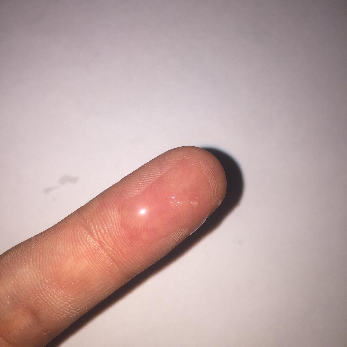 Специально налил суперклей на палец для эксперимента