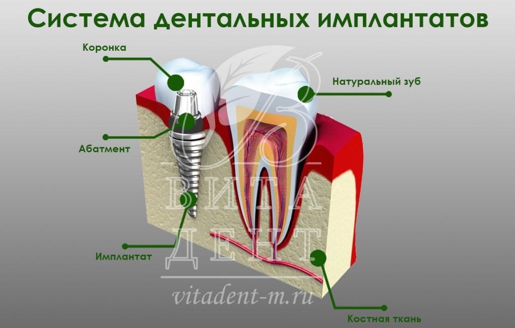 Как оно выглядит на самом деле