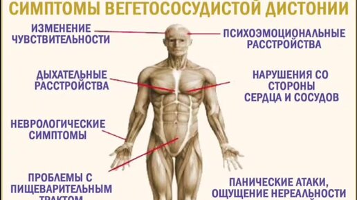 Берут ли с всд. ВСД симптомы у мужчин. Вегетососудистая дистония+клипарт.