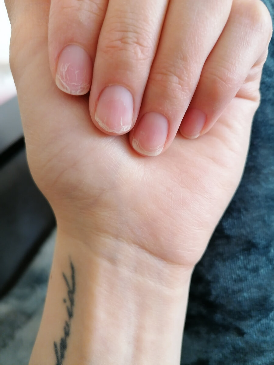 уже почти отросли постоянно ломались и слоились