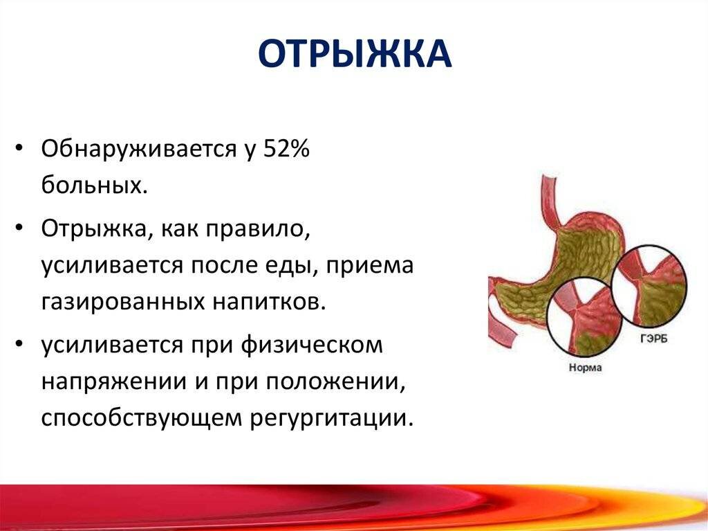 Что нужно знать про изжогу и отрыжку, чтобы навсегда забыть о них