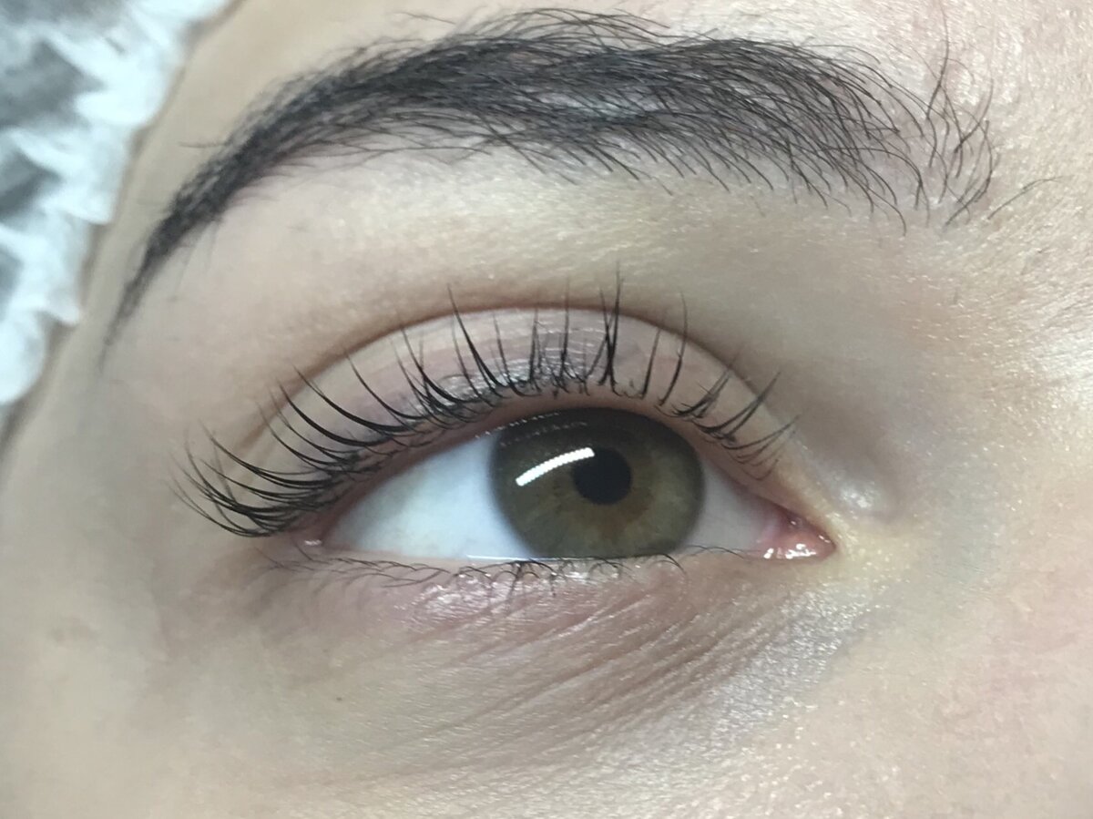 После процедуры 