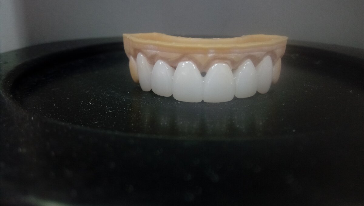 Красиво, но родные зубы не бывают такие белые