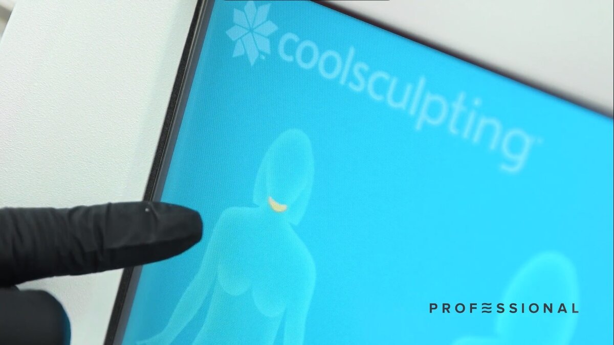 Раньше устранение второго подбородка было под силу только пластической хирургии