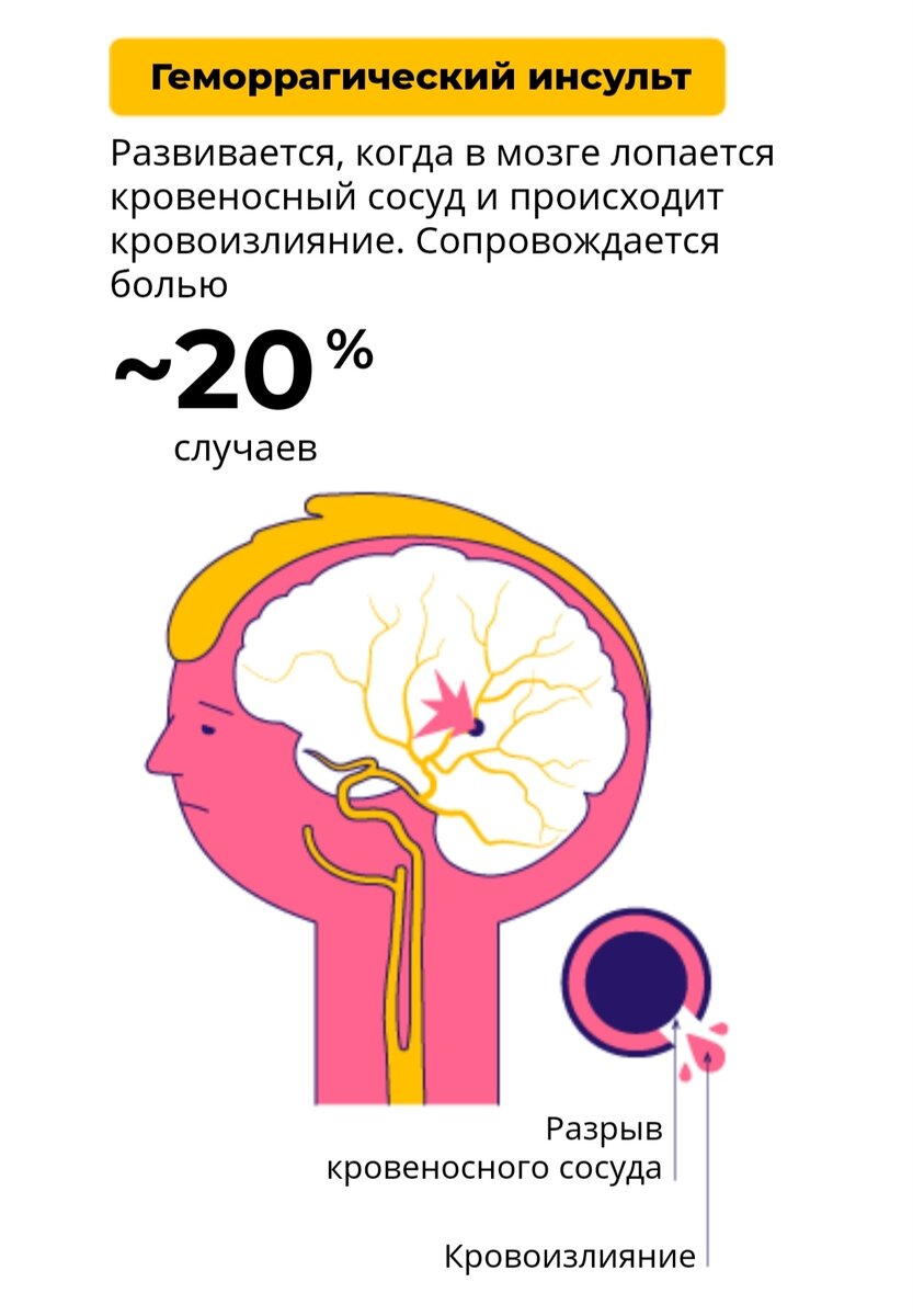 -2-2