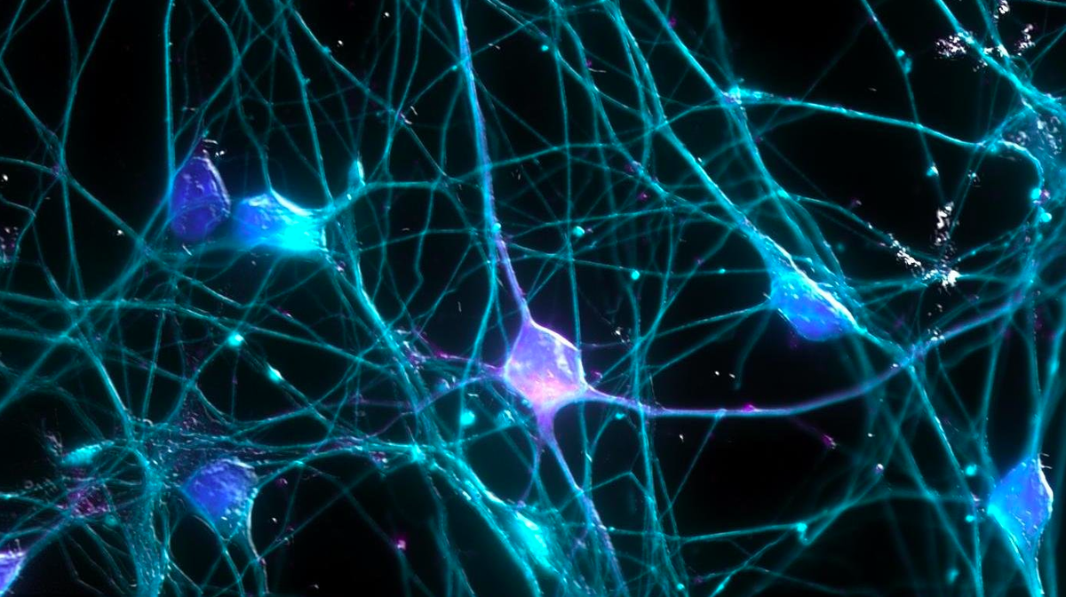 Так выглядят нейроны под электронным микроскопом. 