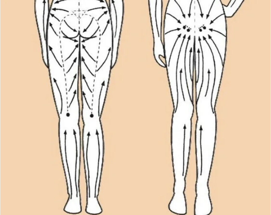 Уроки лимфатического массажа. Массаж тела Гуаша схема антицеллюлитный. Массажные линии тела лимфа. Лимфатическая система массажные линии. Схема проведения лимфодренажного массажа.