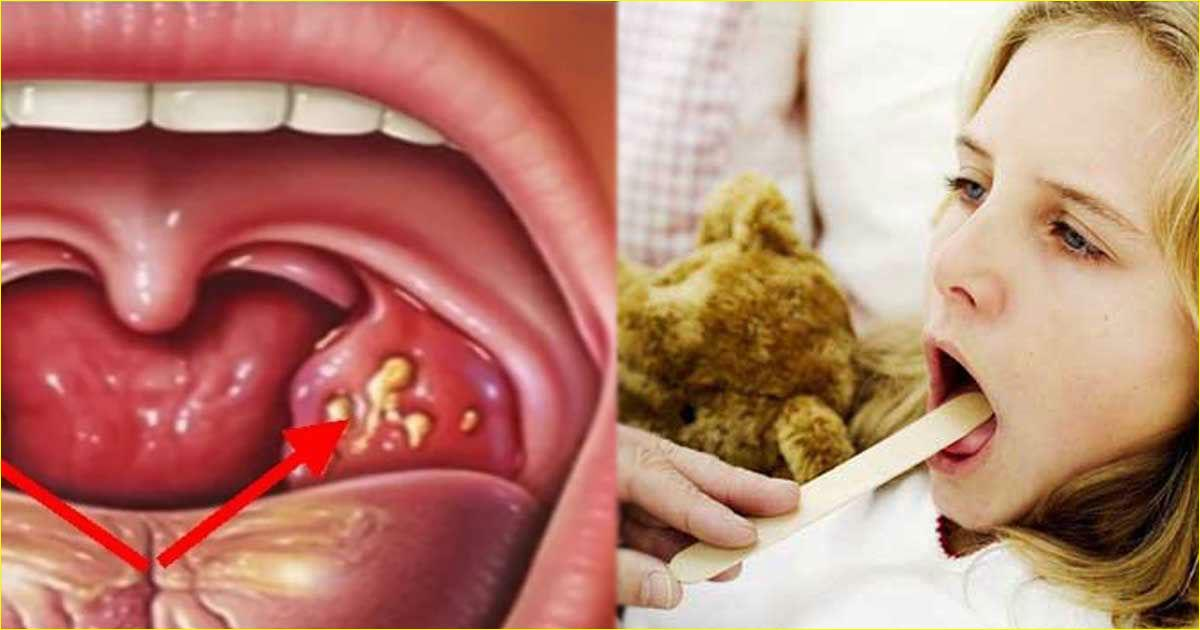 Источник: https://bronkhi.ru