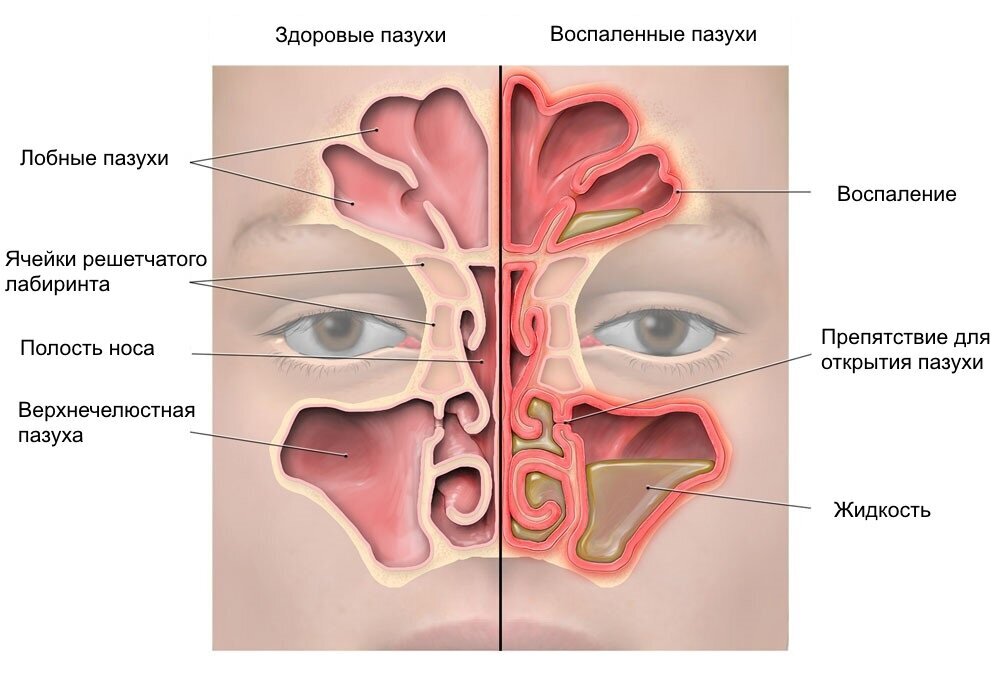 Гайморовы пазухи 3d модель