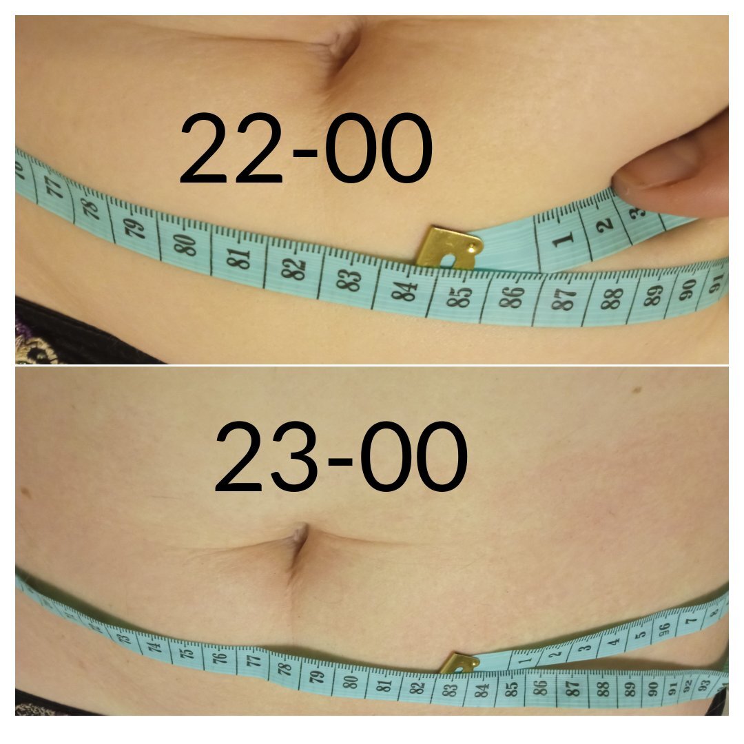 В 23-00 кожа многострадально-покрасневшая, а живота стало меньше