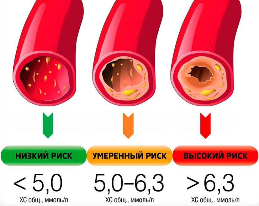 Коэффициент атерогенности