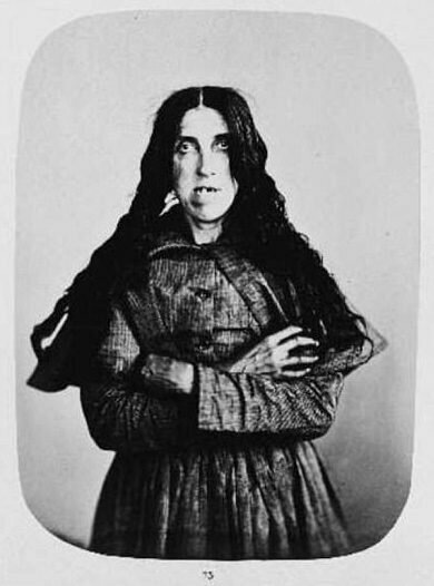 Пациенты Бедлама в 1850-е годы