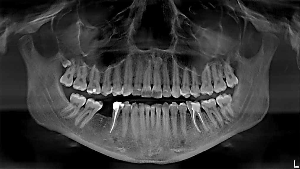 снимок не мой, КДПВ, понятное дело...