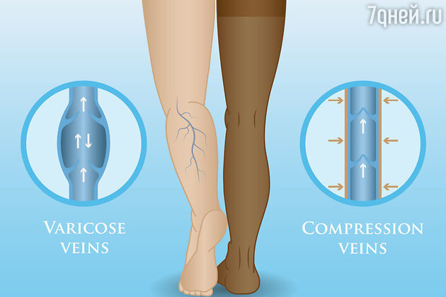 Фото: LEGION-MEDIA