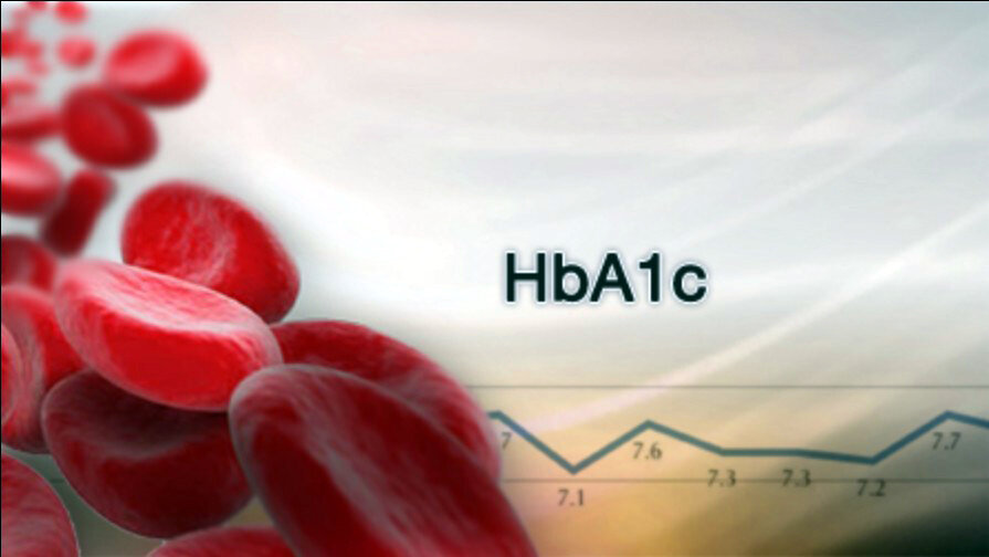 Гликированный гемоглобин (HbA1c) отображает средний уровень сахара в крови за последние 3 месяца.
 Кому этот анализ нужно сдавать?