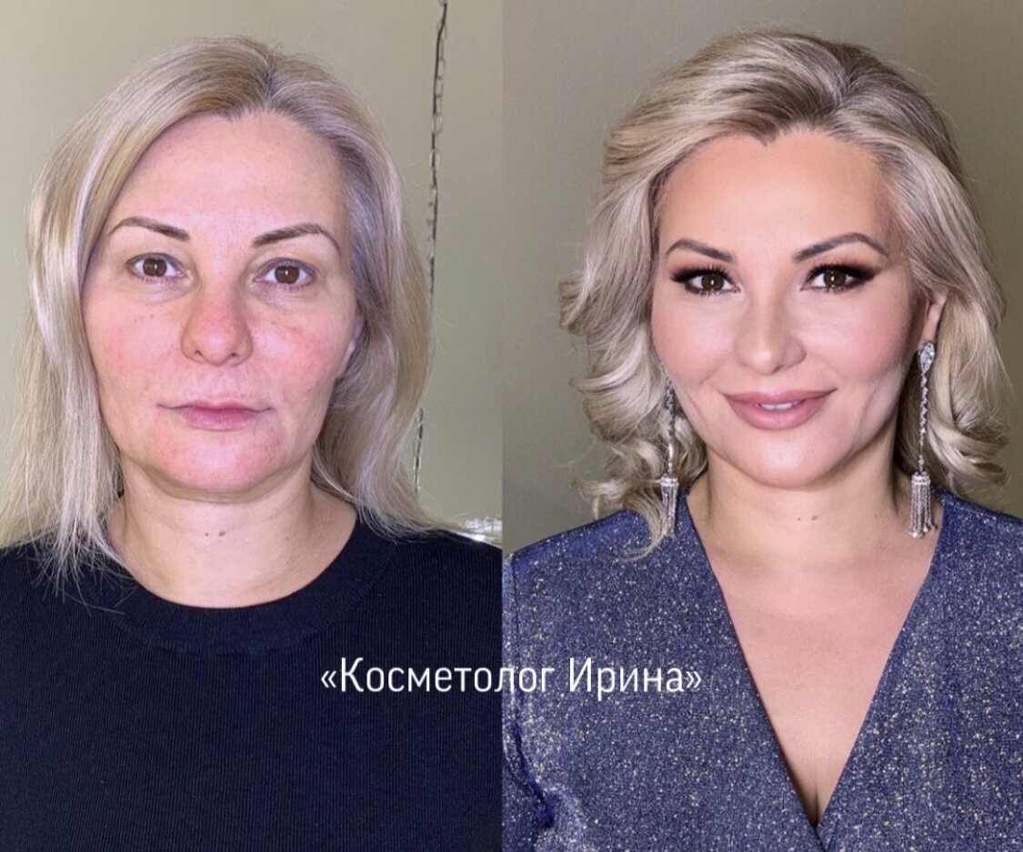 Фотографии моей подруги (до и после преображения) «Косметолог Ирина» 