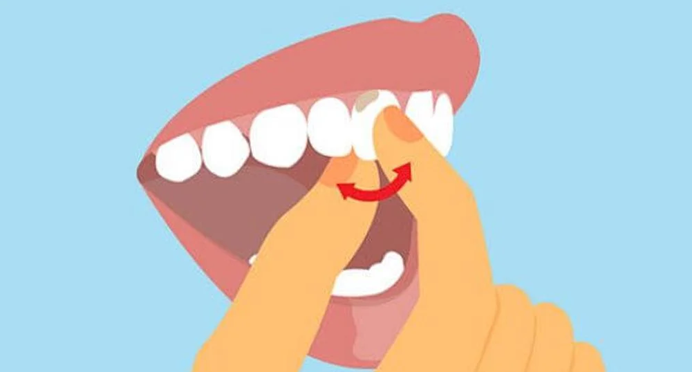 Как вырвать/удалить зуб
