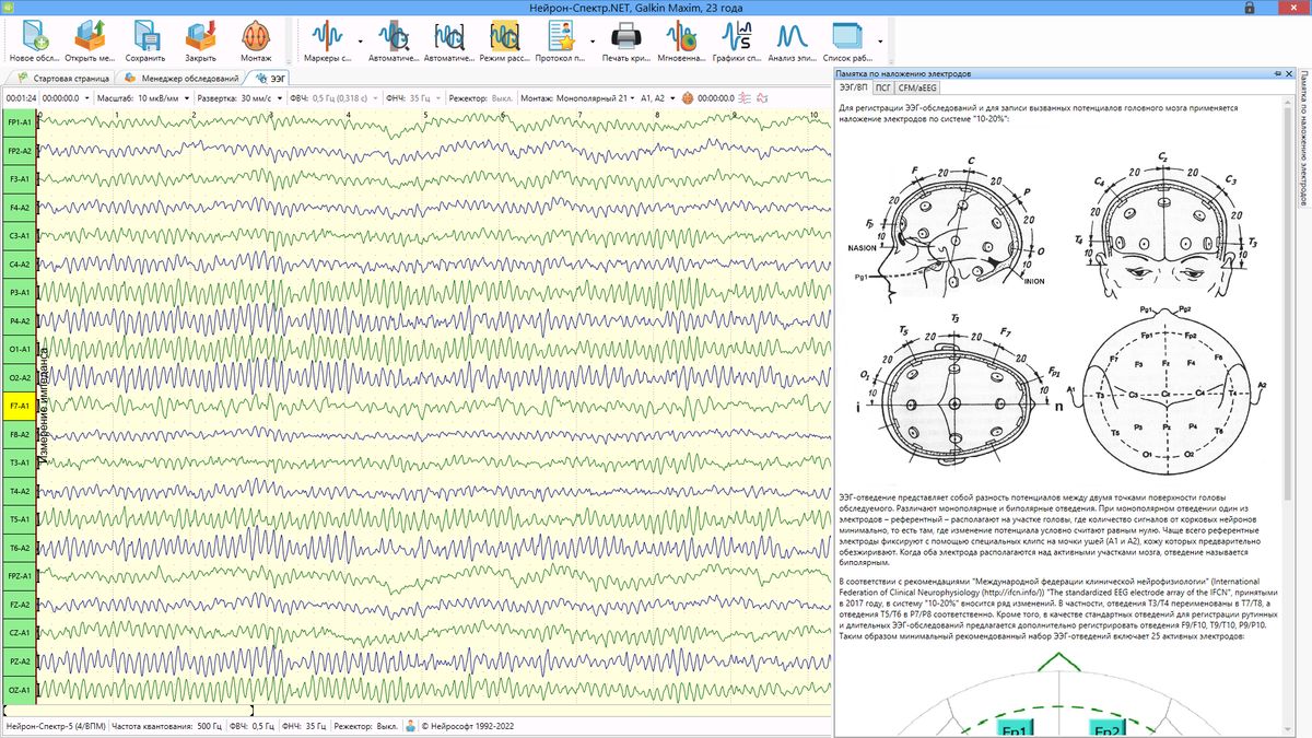 Современное программное обеспечение для регистрации и анализа ЭЭГ |  Электроэнцефалография | Дзен