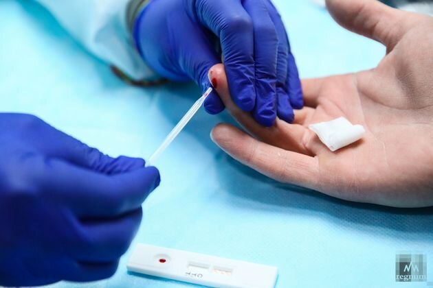    Экспресс-тест на ВИЧ-инфекцию Алексей Колчин © ИА REGNUM