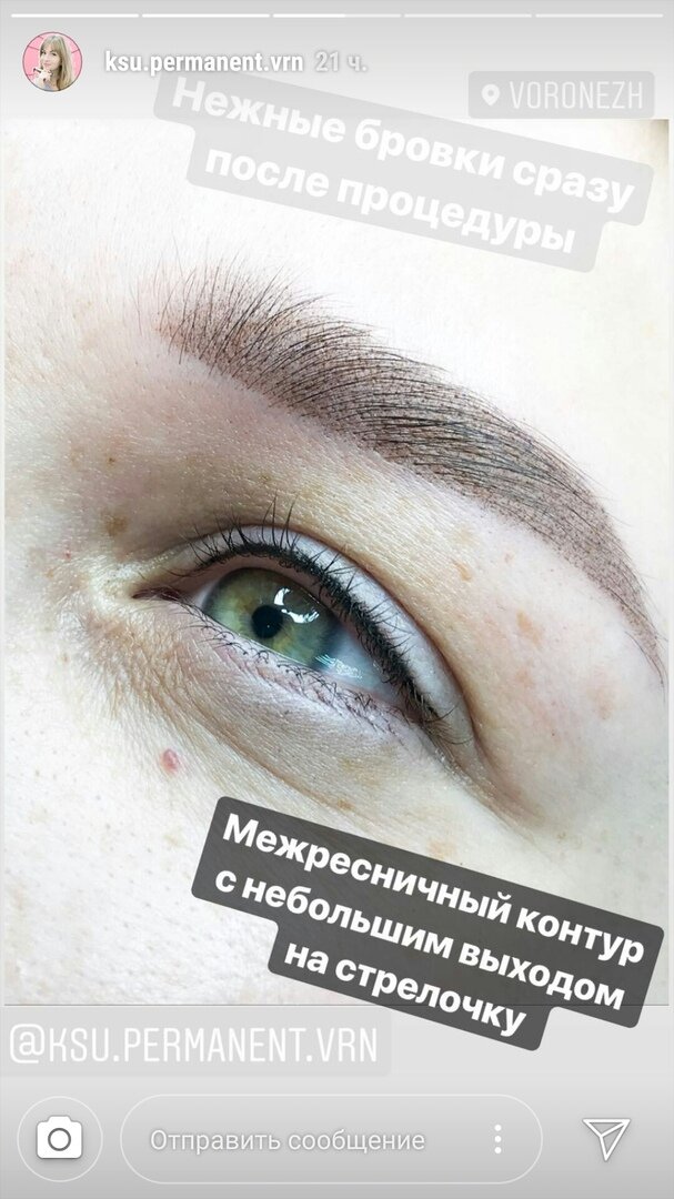 После процедуры