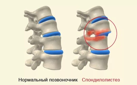 источник http://vseosustavah.com/wp-content/uploads/2016/08/1-85-768x537.jpg