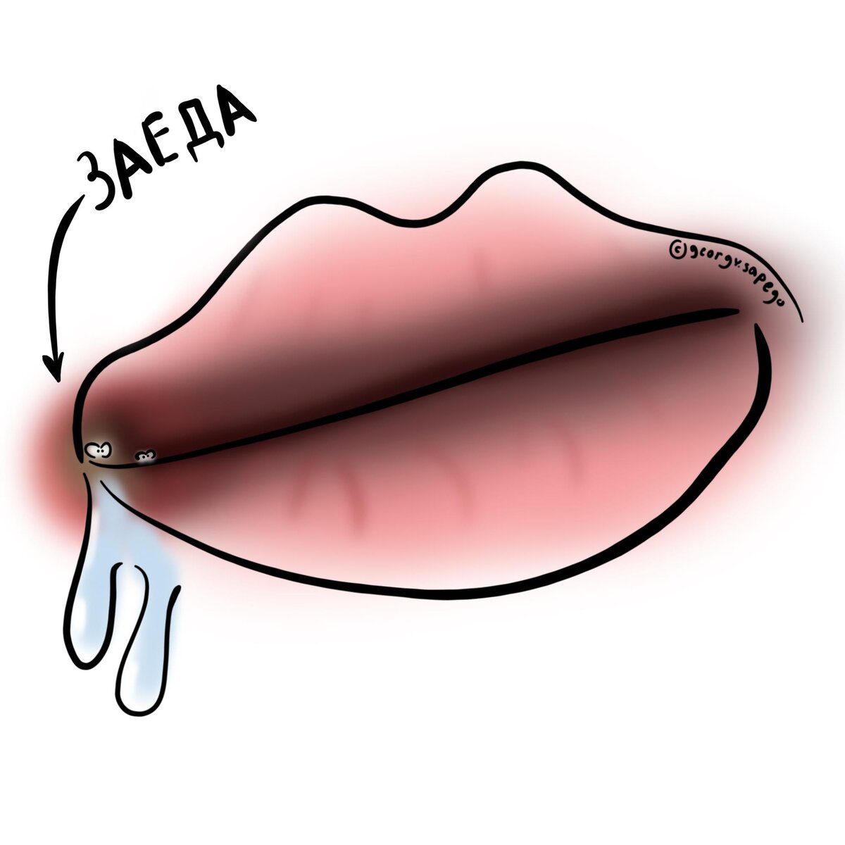 Губа треснула картинка