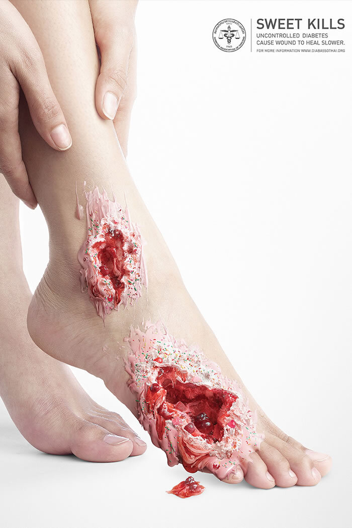 Источник фото: http://everydaydiabetes.com/sweet-kills-campaign/ 
