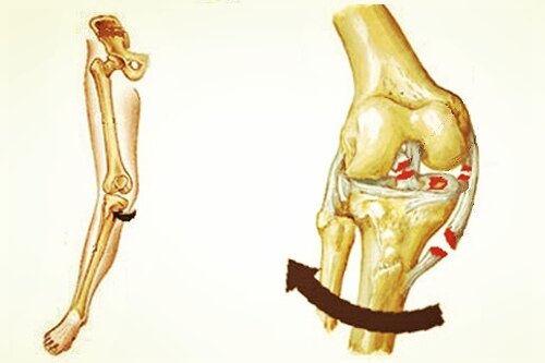 Несчастная триада. Фото из интернета. 