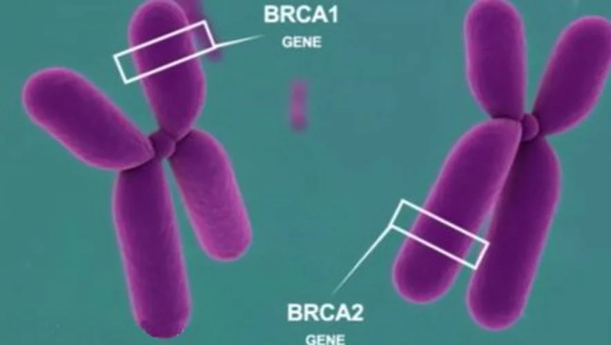 Brca2 рак молочной железы