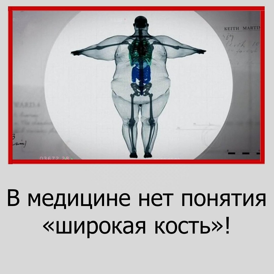 Широкая кость?