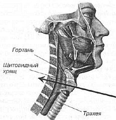 Ложный круп