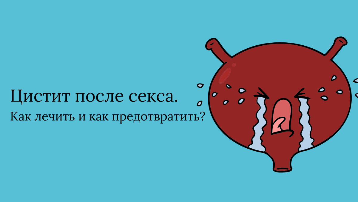 Посткоитальный цистит симптомы