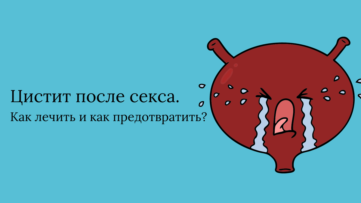 Что делать, если цистит возникает после половога акта? | Разумная  гинекология Елены Ордиянц | Дзен