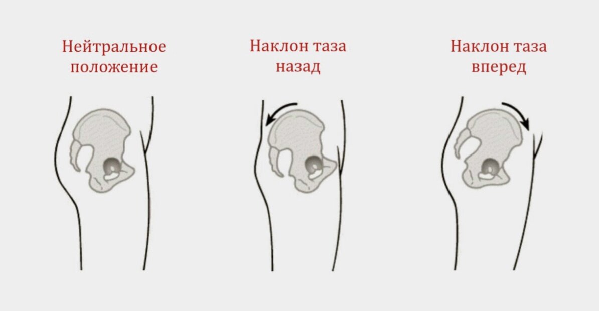 Варианты положения таза. Нам необходимо научиться работать с нейтральным положением. Это самое безопасное и правильное положение таза для тела человека.