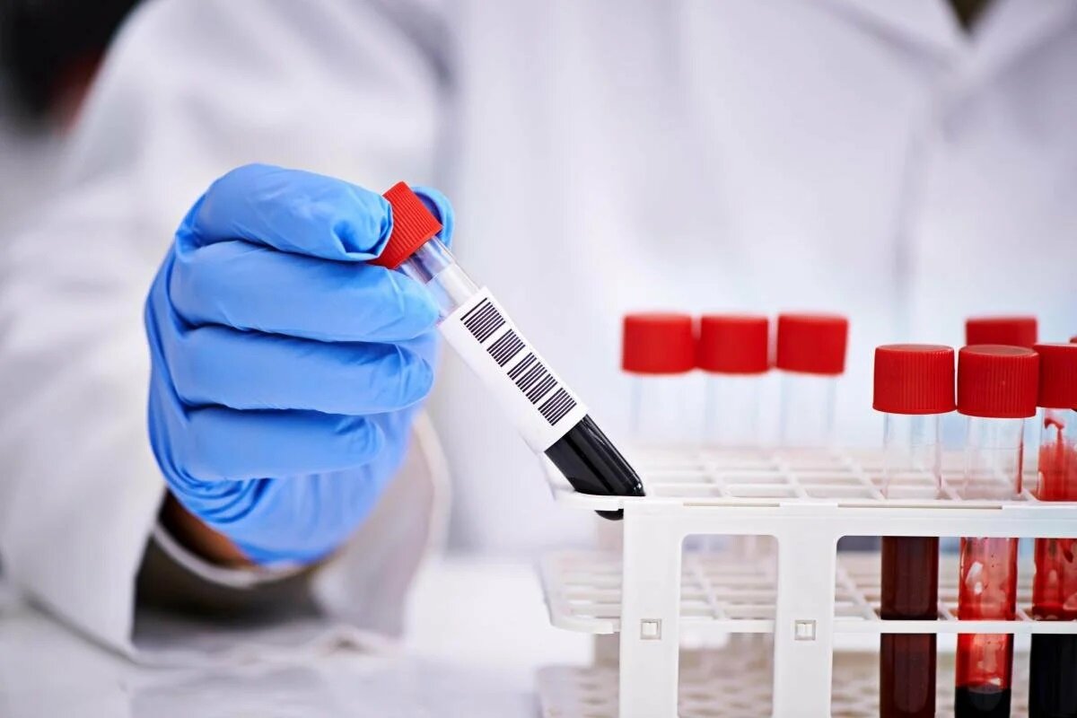 Прайм-тест можно пройти в клинике "ГрандМед"