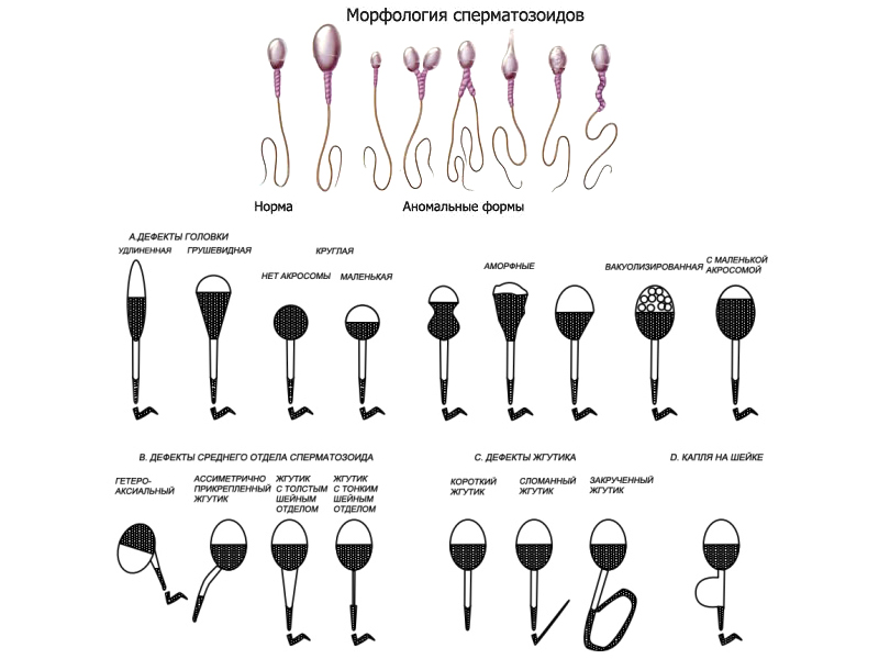 Морфология в спермограмме. Спермограмма по Крюгеру.