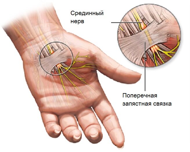 Народные рецепты