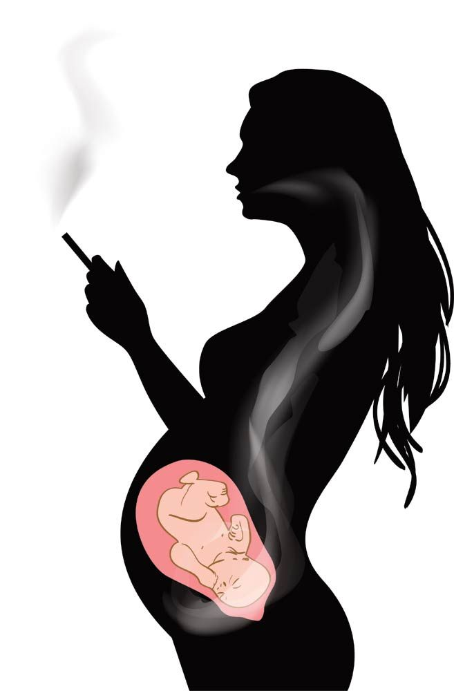 Источник: Яндекс. Картинки