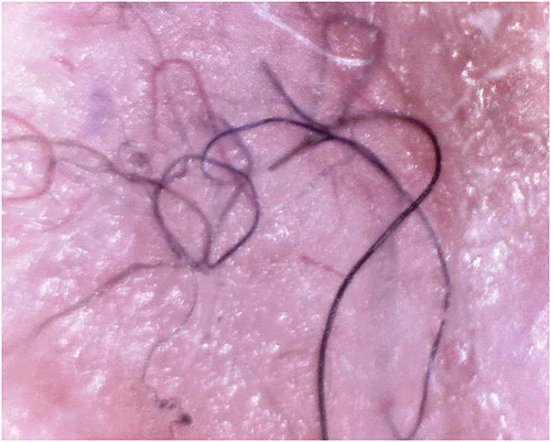 волокна в коже