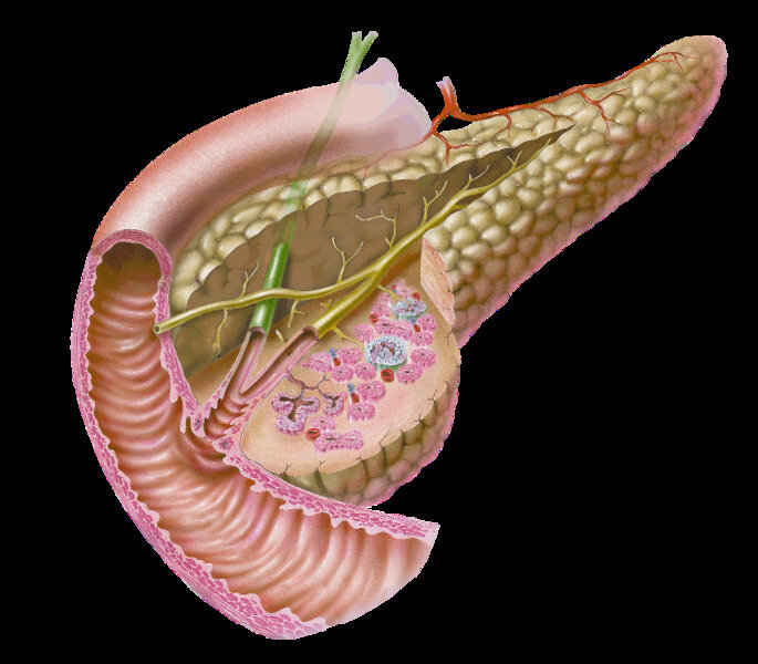 Поджелудочная железа pancreas. Острый панкреатит анатомия поджелудочной железы. Панкреонекроз поджелудочной панкреатит.