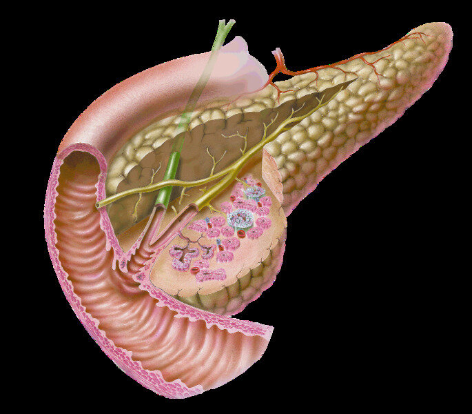 Поджелудочная плохая. Санториниев проток поджелудочной железы. Санториниев проток поджелудочной железы анатомия. Поджелудочная железа (pancreas). Острый панкреатит анатомия поджелудочной железы.