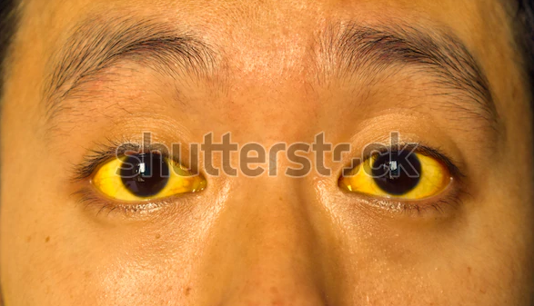 фото с shutterstock.com