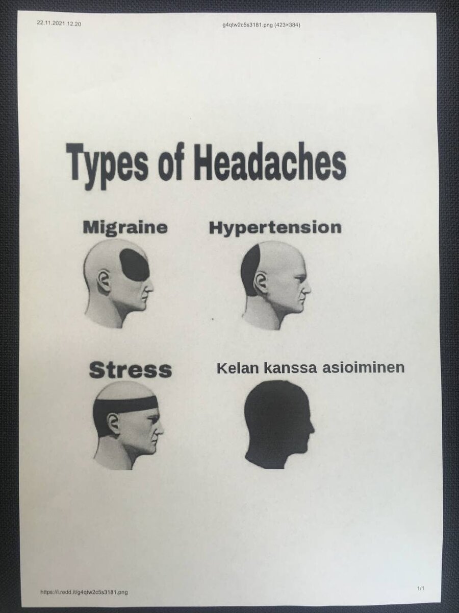 На работе у нас валялась такая замечательная распечатка.                                          "Виды головной боли: 1-мигрень, 2-гипертония, 3-стресс, 4- решение дел с Кела".